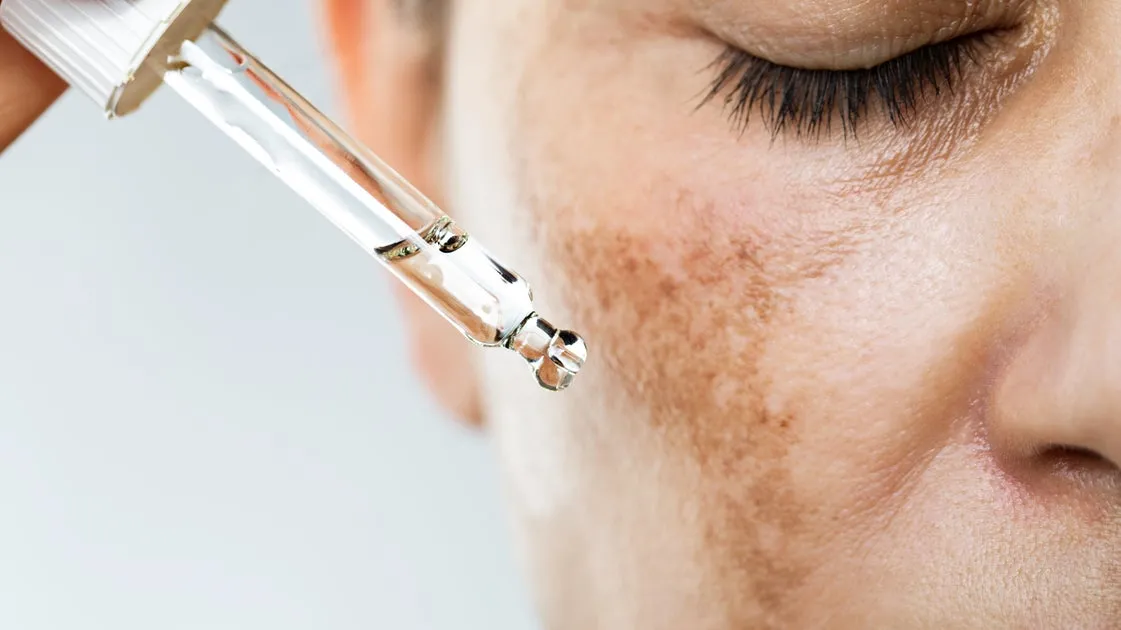 Melazma ve Lekelerle Savaş: Dermatologların Önerdiği En Etkili Ürünler