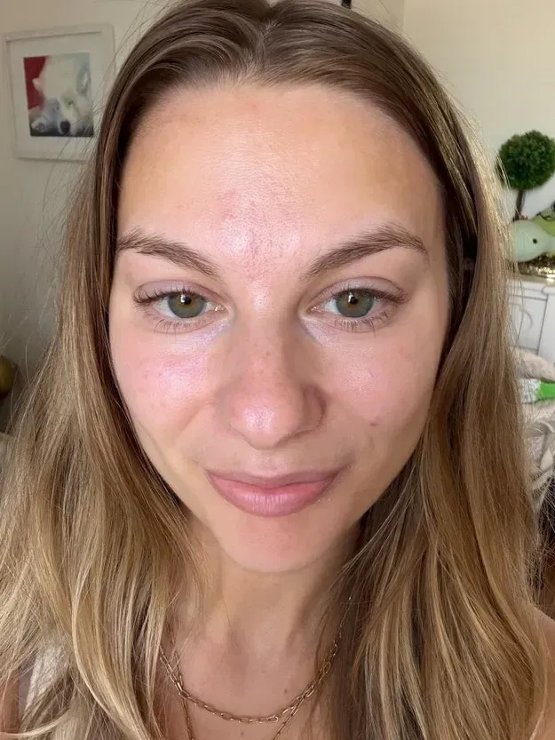 Biodance Bio-Collagen Maske: Sosyal Medyanın Popüler Ürünü Cilde Ne Vadediyor?